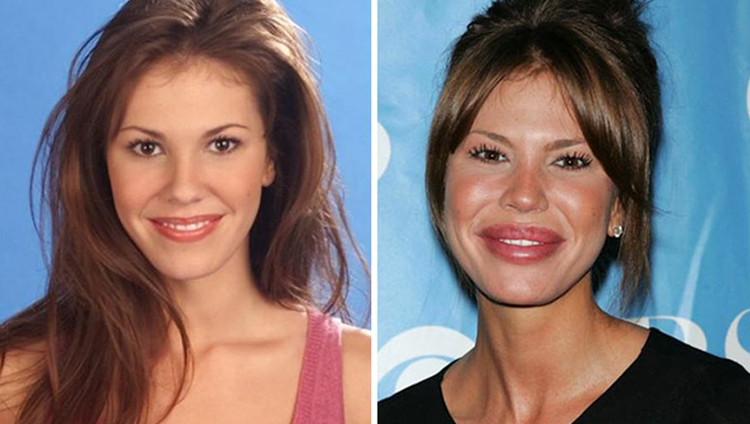 Celebrity-Nikki-Cox-Plastic-Surgery.png