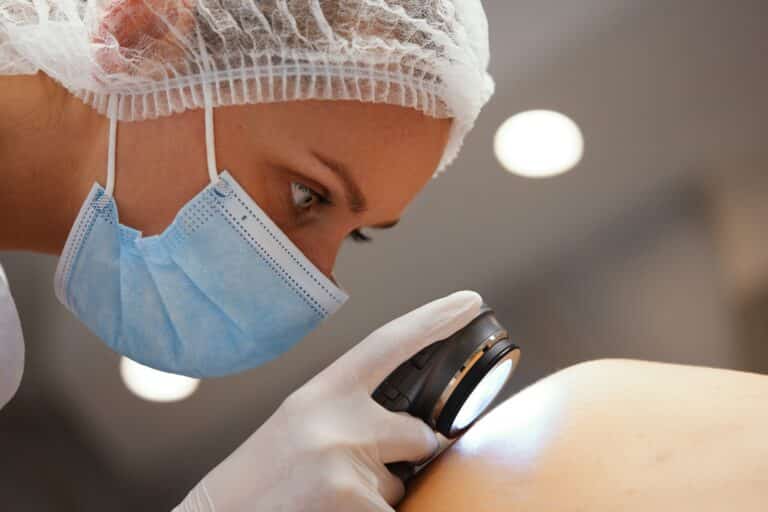 Is Melanoma Genetic?