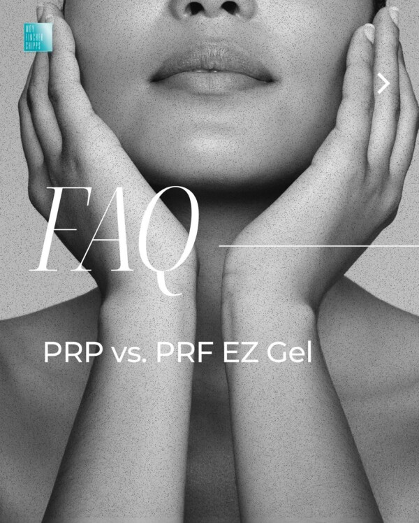 PRP vs. PRF EZ Gel: What’s the Difference? 💉Both PRP (Platelet-Rich Plasma) and PRF EZGel (Platelet-Rich Fibrin) use your own blood to stimulate collagen, promote healing, and rejuvenate your skin—but what sets them apart? Let’s break it down! ⬇️

🔬 PRP:
✔️ Higher concentration of platelets
✔️ Liquid consistency for easy application
✔️ Best for hair restoration, microneedling, and injections

🩸 PRF EZ Gel:
✔️ Fibrin matrix for longer-lasting results
✔️ Thicker, gel-like consistency for added volume
✔️ Ideal for natural under-eye rejuvenation, fine lines, and skin tightening

Both are powerful, regenerative treatments—which one is right for you? Swipe through to learn more & book your consultation! ✨

3 easy ways to book!
Book Online: link in bio
Text: 424.496.3537
Call: 310.274.5372

MoyFincherChipps BeverlyHills LA LosAngeles LASkin CosmeticDermatology PRP PRFEZGel FAQ