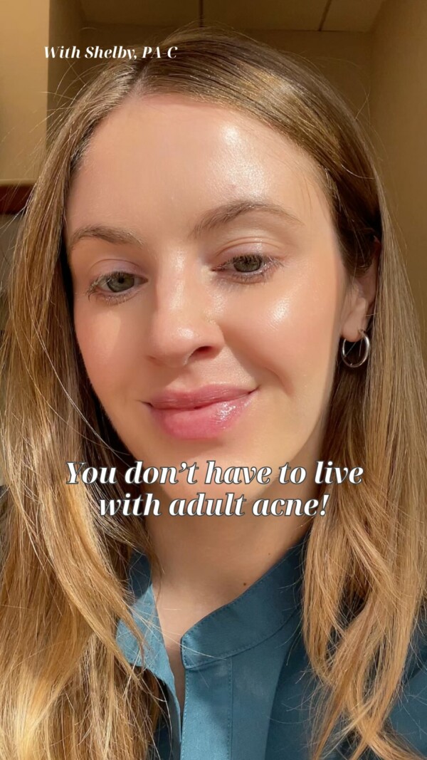 Adult acne? You’re not alone—and you don’t have to live with it. 💬It’s incredibly common, and there are a variety of effective treatments available—from topical and oral medications to in-office procedures that target both active breakouts and scarring.

There’s no one-size-fits-all solution—but there is a treatment plan that’s right for you.

📅 Book an appointment and let’s find what works for your skin.
3 easy ways to book!
Book Online: link in bio
Text: 424.496.3537
Call: 310.274.5372

MoyFincherChipp LA BeverlyHills AcneAwarenessMonth AdultAcne Acne AcneTreatments